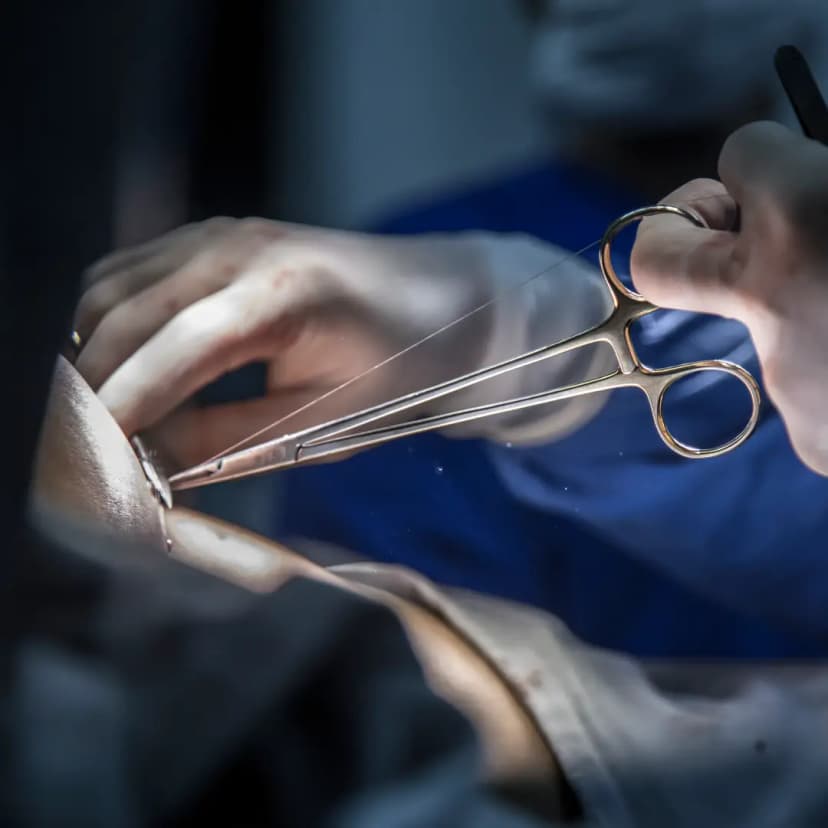 Minimal Access Surgery