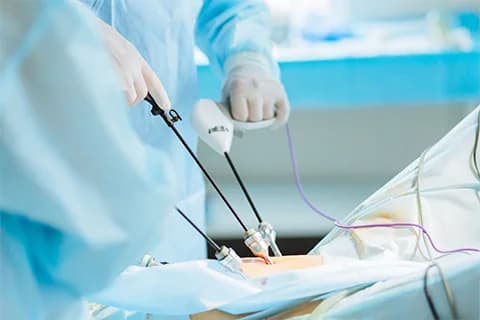 Gynaecological Laparoscopic Surgery