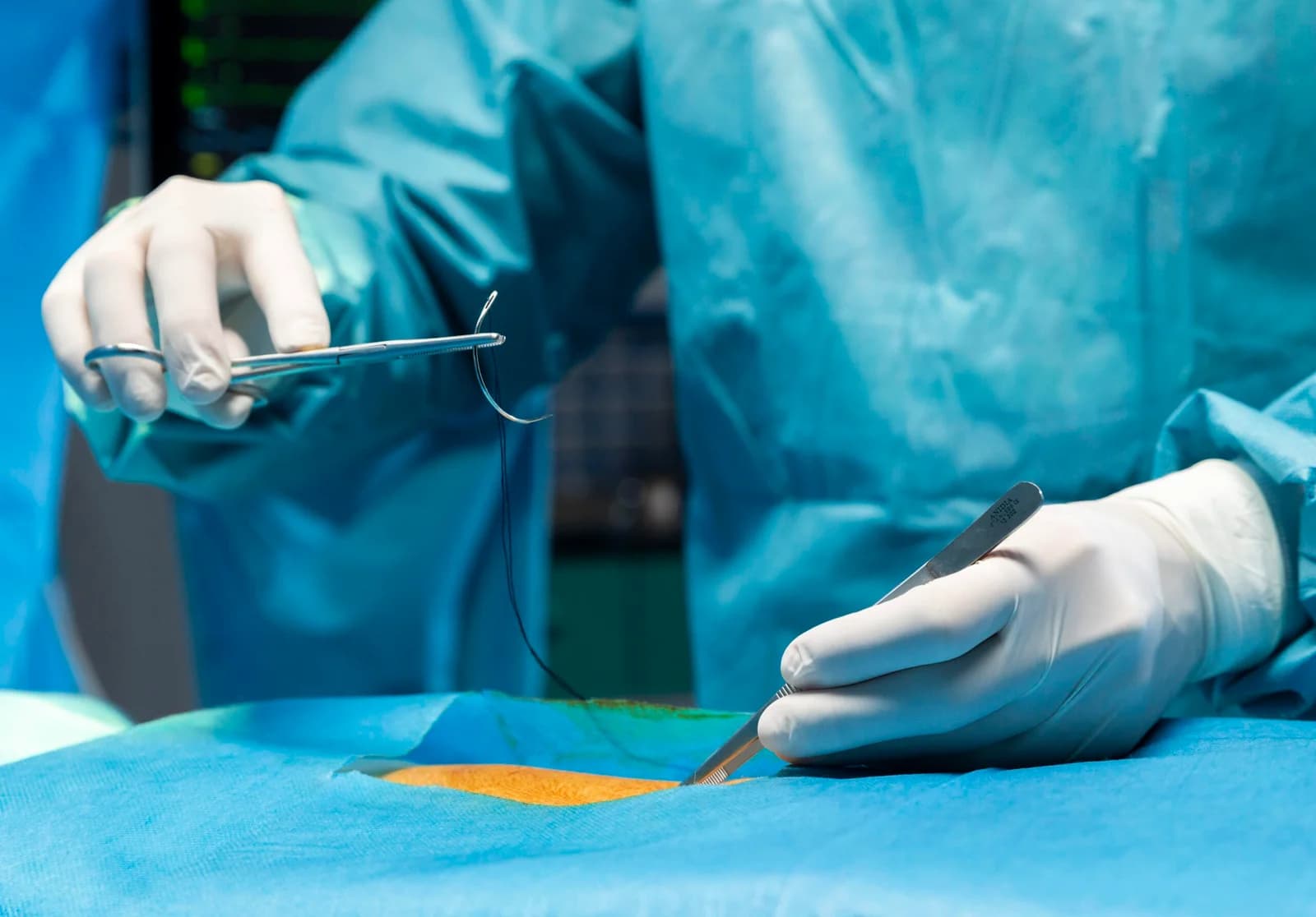 Caesarean Delivery